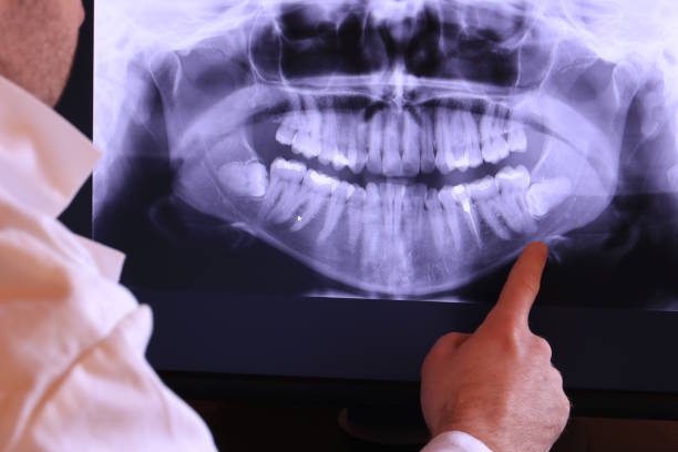 Best Emergency Dental Extractions in Gladwin, MI